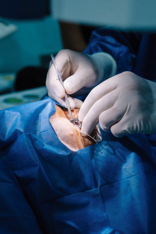 5 greșeli care pot complica operația de cataractă (și cum le eviți)